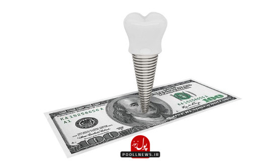 سرمایه‌گذاری مطمئن برای جایگزین دندان با ایمپلنت