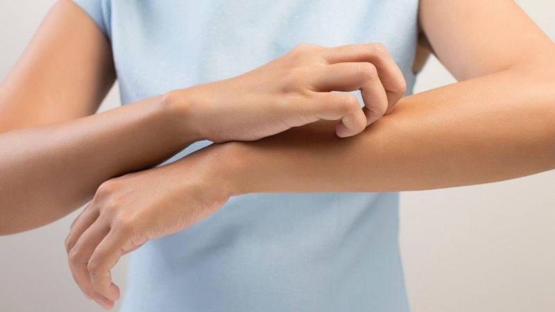 دلایل ایجاد لکه های قرمز روی پوست چیست؟ دلایل ایجاد لکه های قرمز روی پوست چیست؟