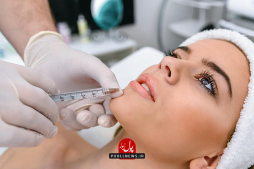 تزریق ژل لب در کرج