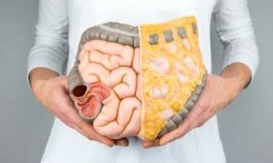 فردی که آناتومی روه های یک انسان را در دست دارد | علائم سرطان روده
